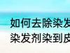 如何去除染发剂染在皮肤上的颜色 被染发剂染到皮肤如何处理